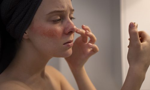 Pele Oleosa: O Guia Completo para Cuidar da Sua Pele com Produtos Naturais